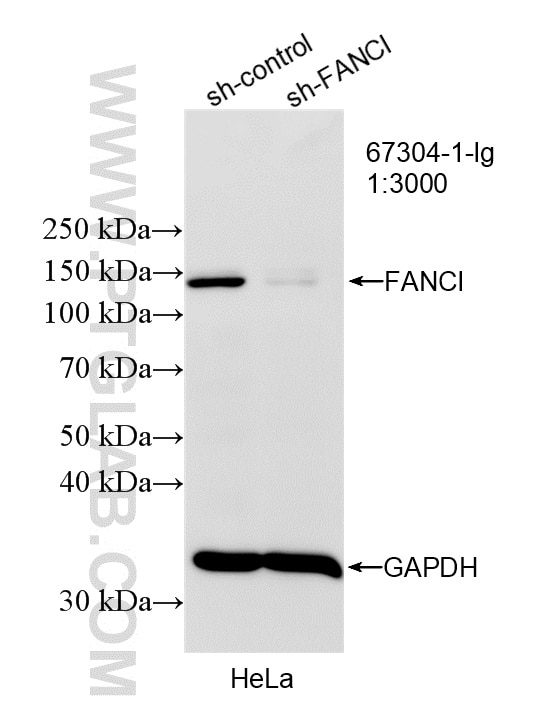 Western Blot (WB) analysis of HeLa cells using FANCI Monoclonal antibody (67304-1-Ig)