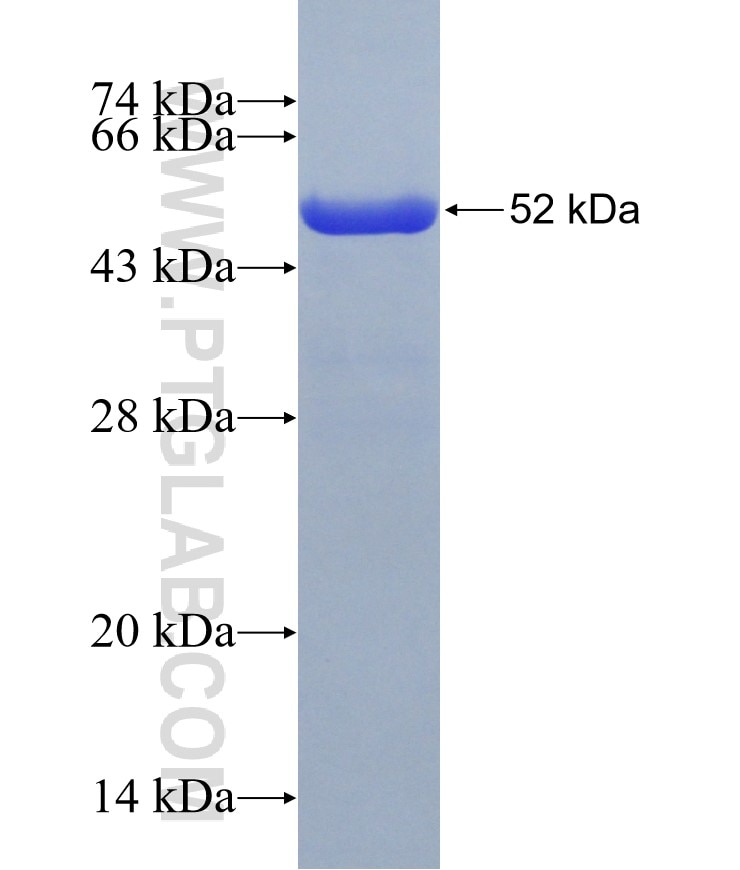 FANCI fusion protein Ag14386 SDS-PAGE