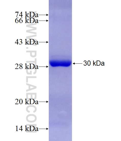 FANCI fusion protein Ag15153 SDS-PAGE