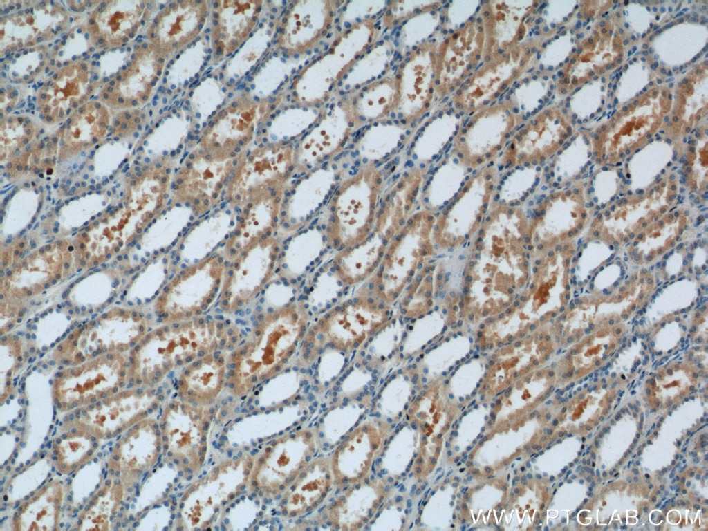 Immunohistochemistry (IHC) staining of human kidney tissue using FANCL Polyclonal antibody (14454-1-AP)
