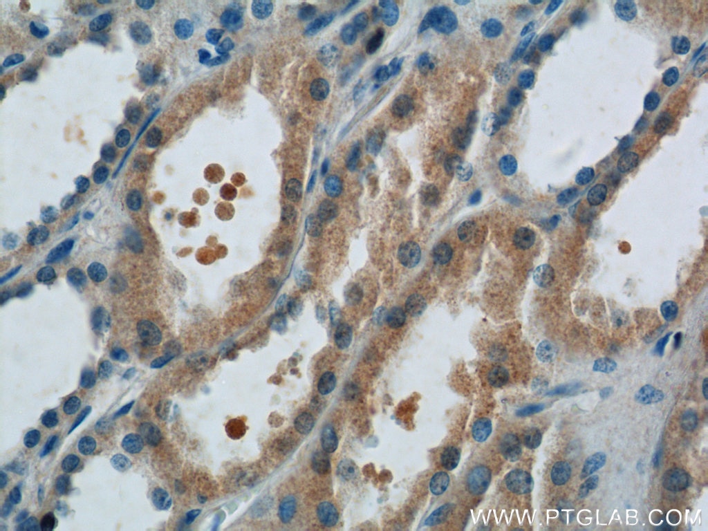 Immunohistochemistry (IHC) staining of human kidney tissue using FANCL Polyclonal antibody (14454-1-AP)