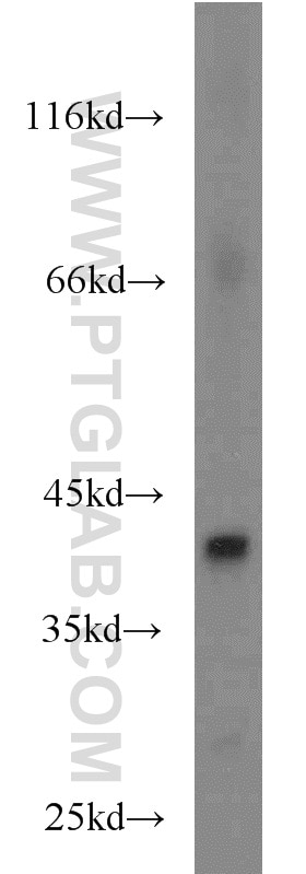 Western Blot (WB) analysis of human brain tissue using FANCL Polyclonal antibody (19187-1-AP)