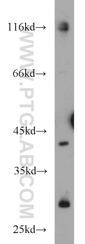 Western Blot (WB) analysis of HEK-293 cells using FANCL Polyclonal antibody (19187-1-AP)