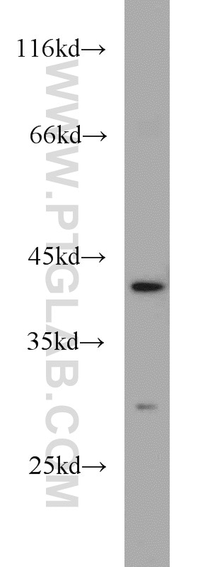 Western Blot (WB) analysis of human brain tissue using FANCL Polyclonal antibody (19187-1-AP)