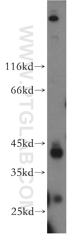 Western Blot (WB) analysis of HeLa cells using FANCL Polyclonal antibody (19187-1-AP)