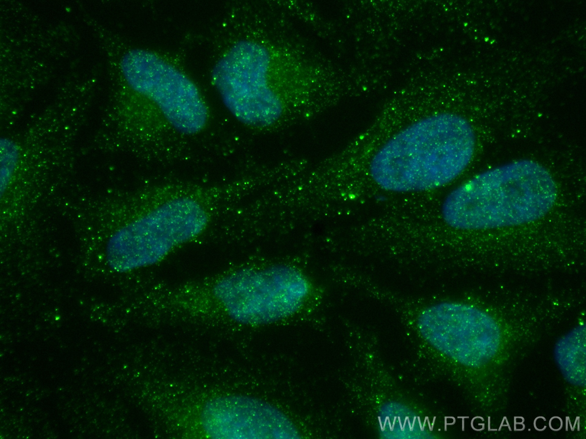 Immunofluorescence (IF) / fluorescent staining of HeLa cells using FANCL Monoclonal antibody (66639-1-Ig)