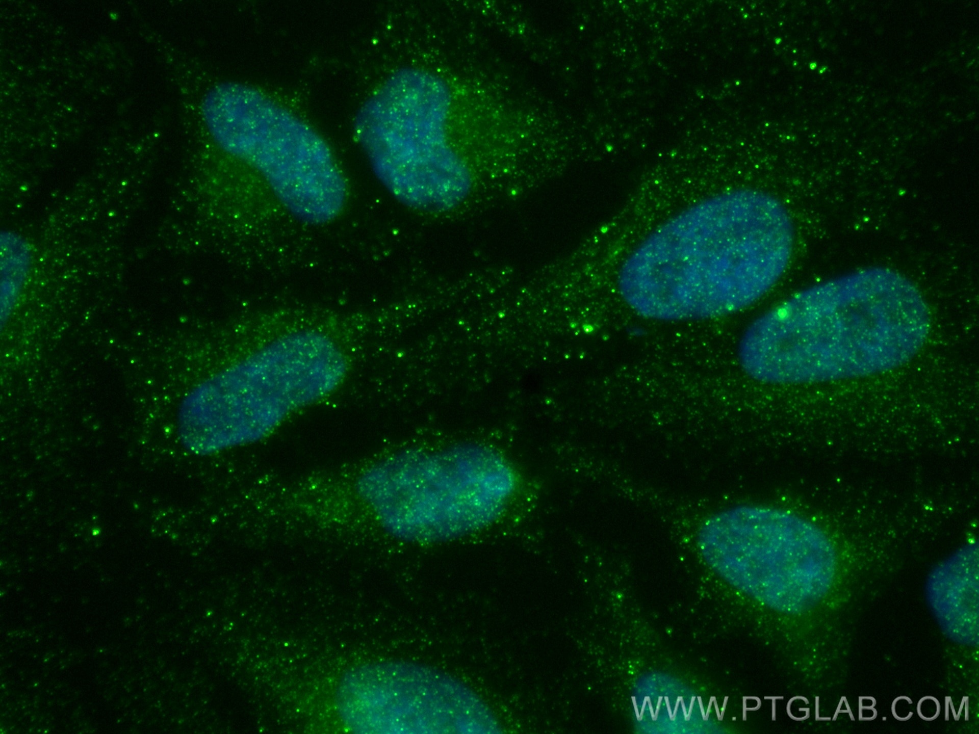 IF Staining of HeLa using 66639-1-Ig