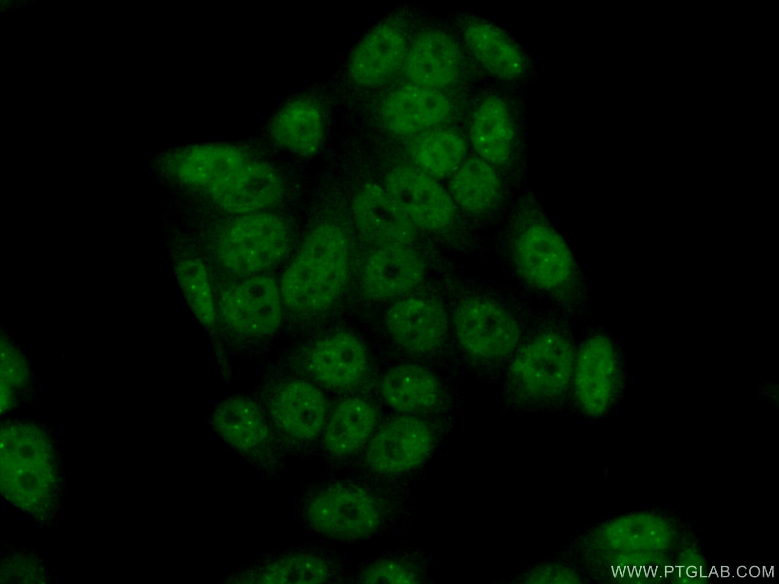 Immunofluorescence (IF) / fluorescent staining of HeLa cells using FANCM Polyclonal antibody (12954-1-AP)