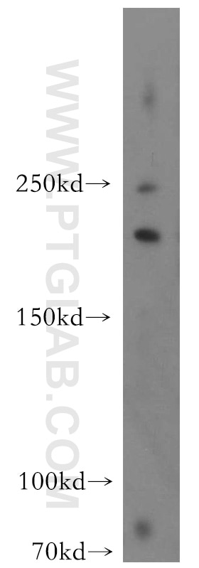 Western Blot (WB) analysis of HeLa cells using FANCM Polyclonal antibody (12954-1-AP)