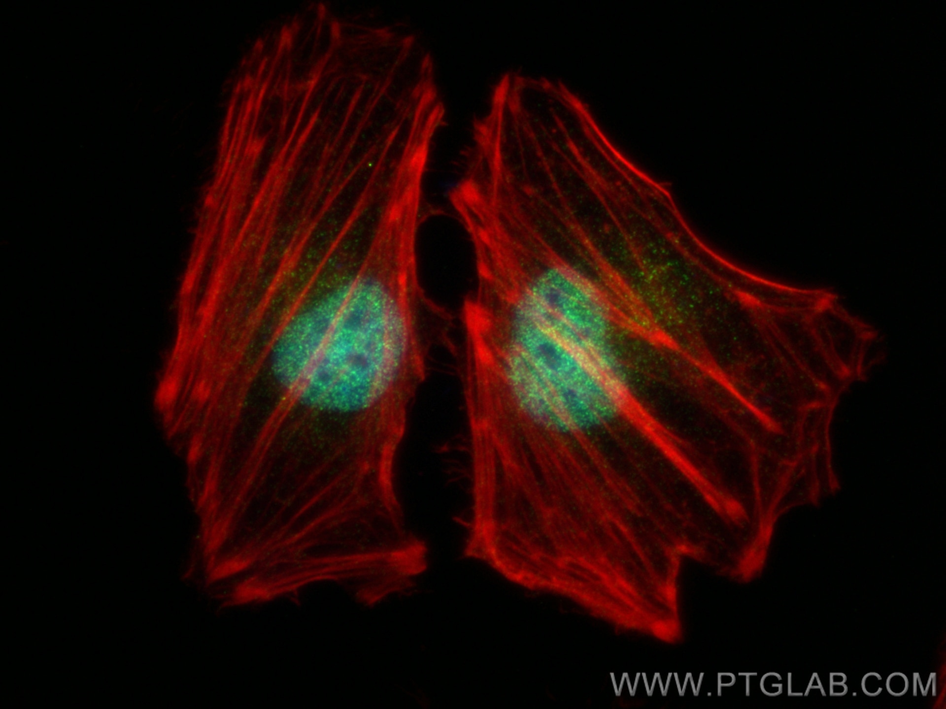 Immunofluorescence (IF) / fluorescent staining of HeLa cells using FANCM Recombinant antibody (82897-1-RR)