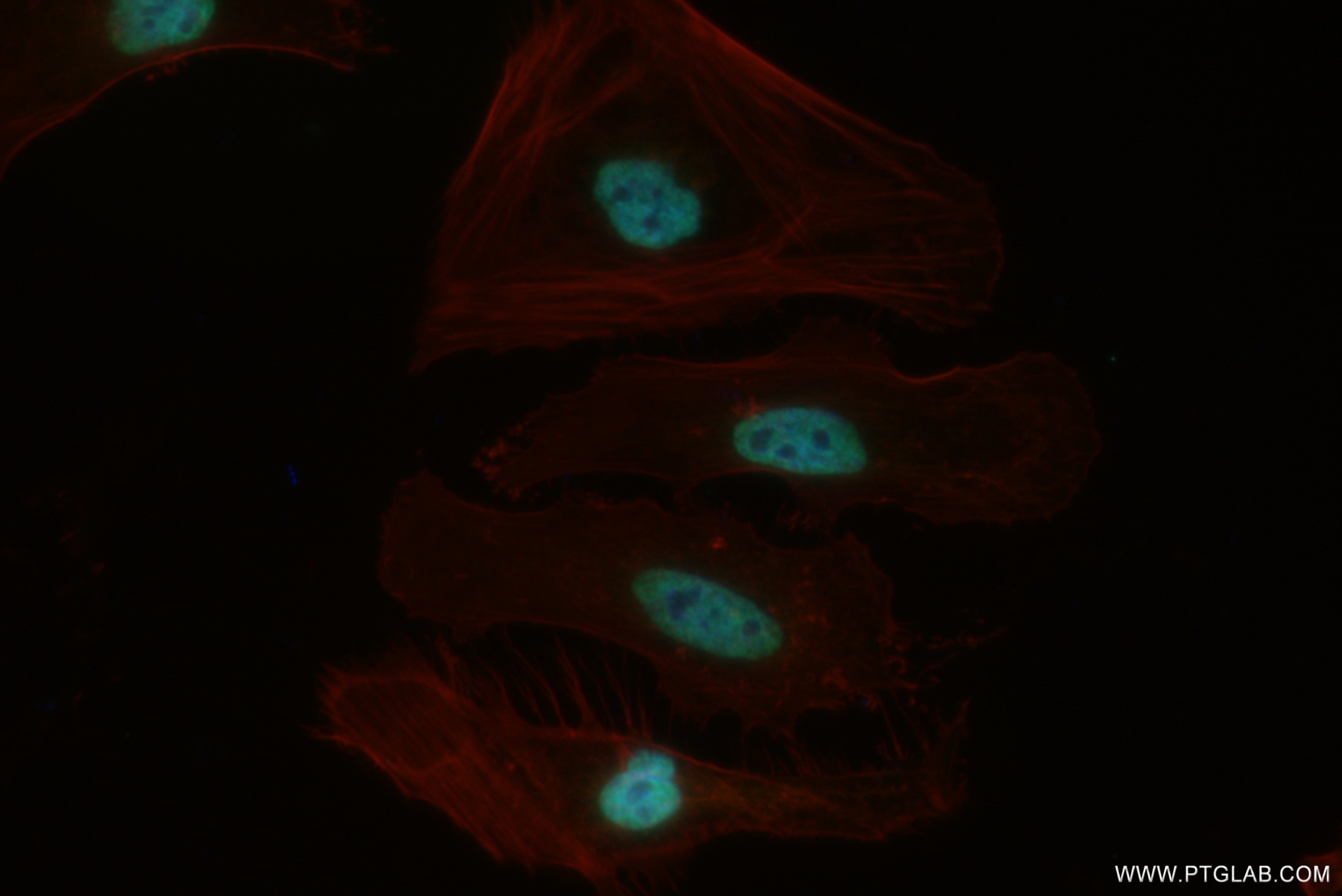 IF Staining of HeLa using 82897-2-RR