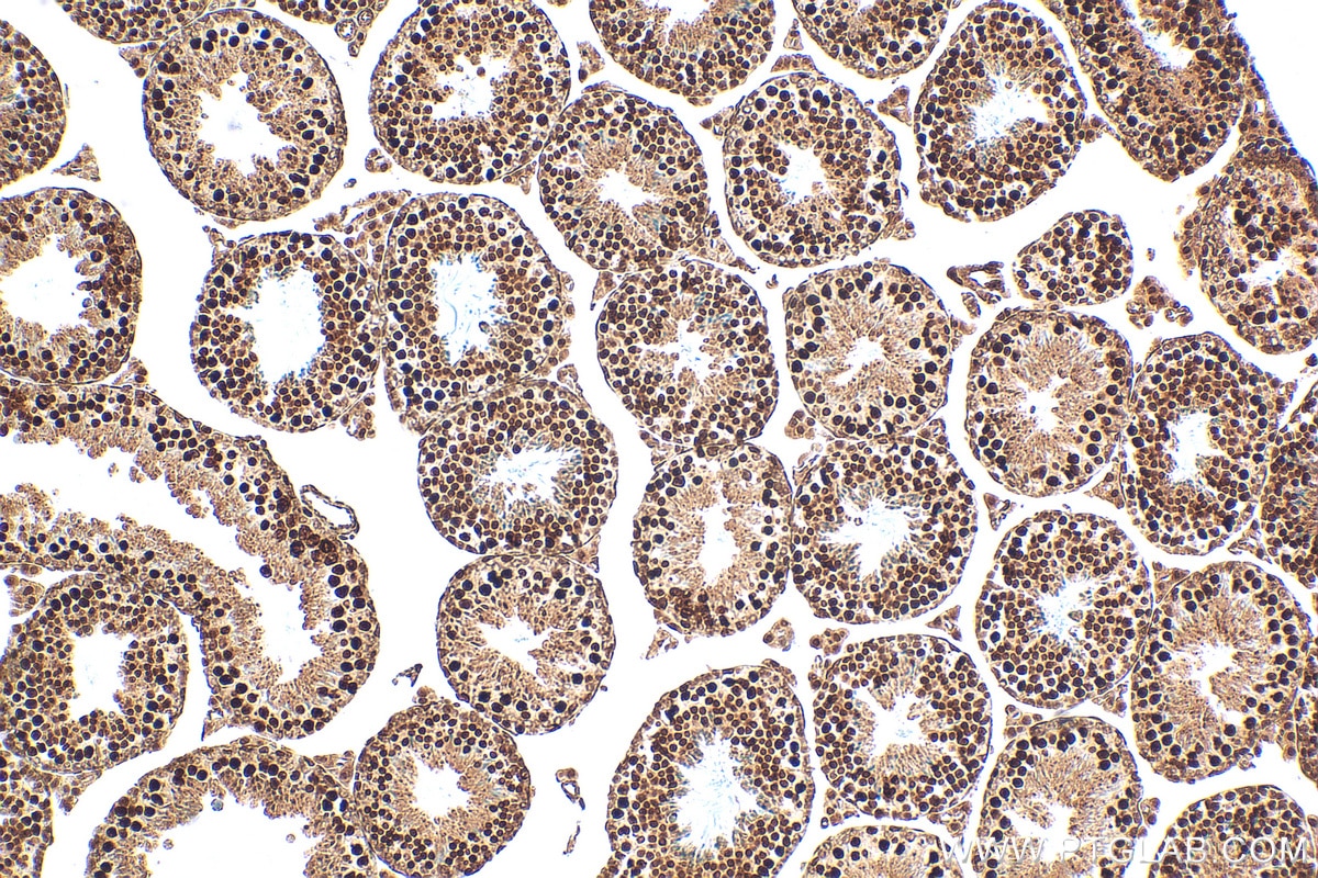 IHC staining of mouse testis using 82897-2-RR