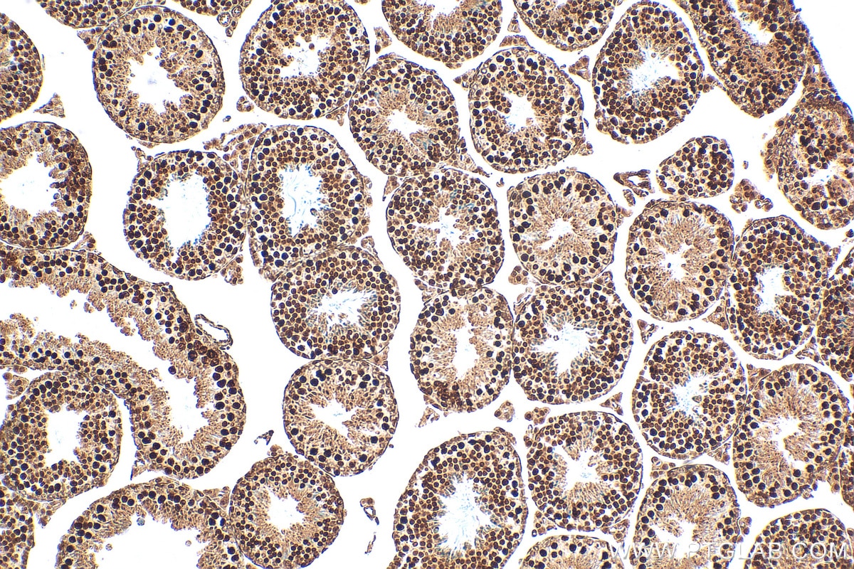 Immunohistochemistry (IHC) staining of mouse testis tissue using FANCM Recombinant antibody (82897-2-RR)