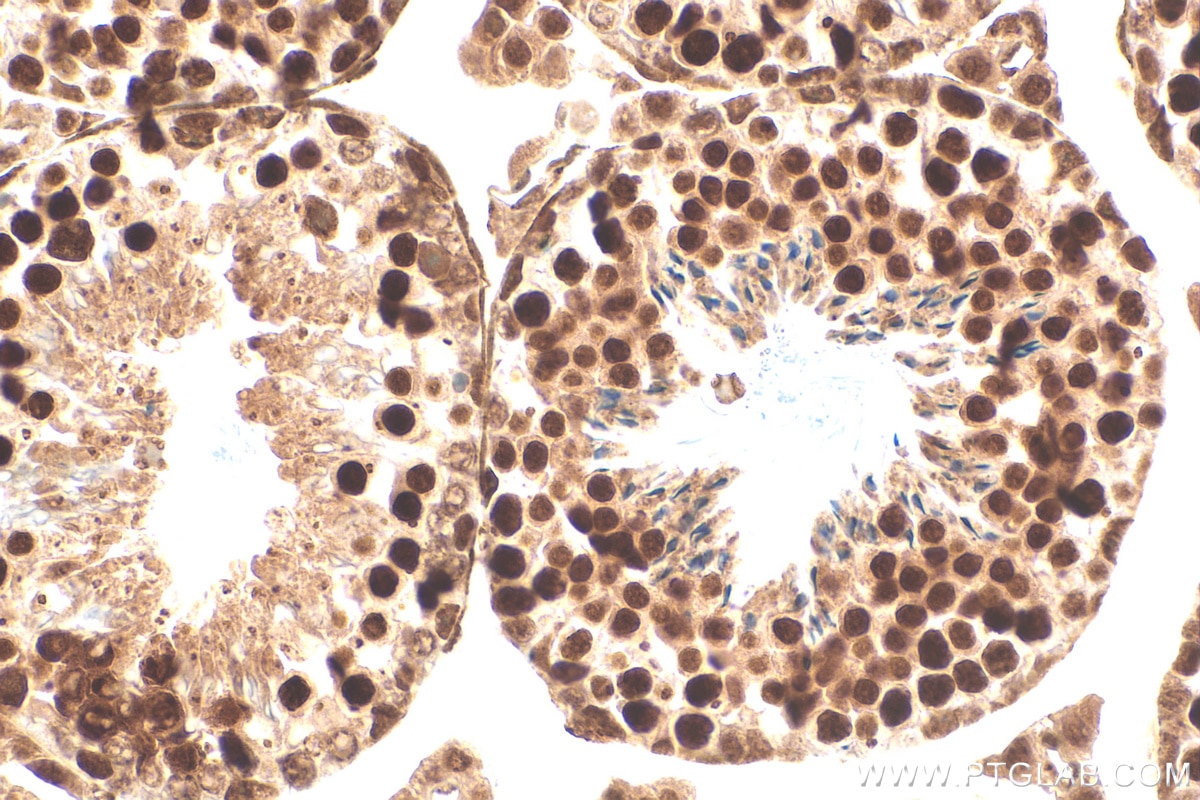 IHC staining of mouse testis using 82897-2-RR