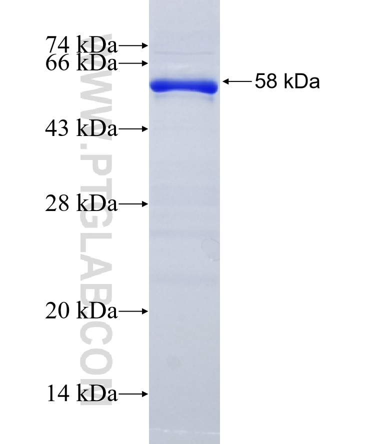 FANCM fusion protein Ag34447 SDS-PAGE
