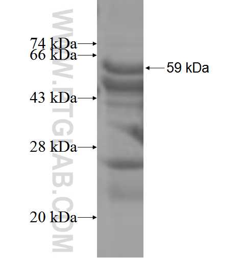 FANCM fusion protein Ag3618 SDS-PAGE