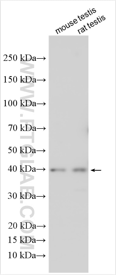 Western Blot (WB) analysis of various lysates using FANK1 Polyclonal antibody (17167-1-AP)