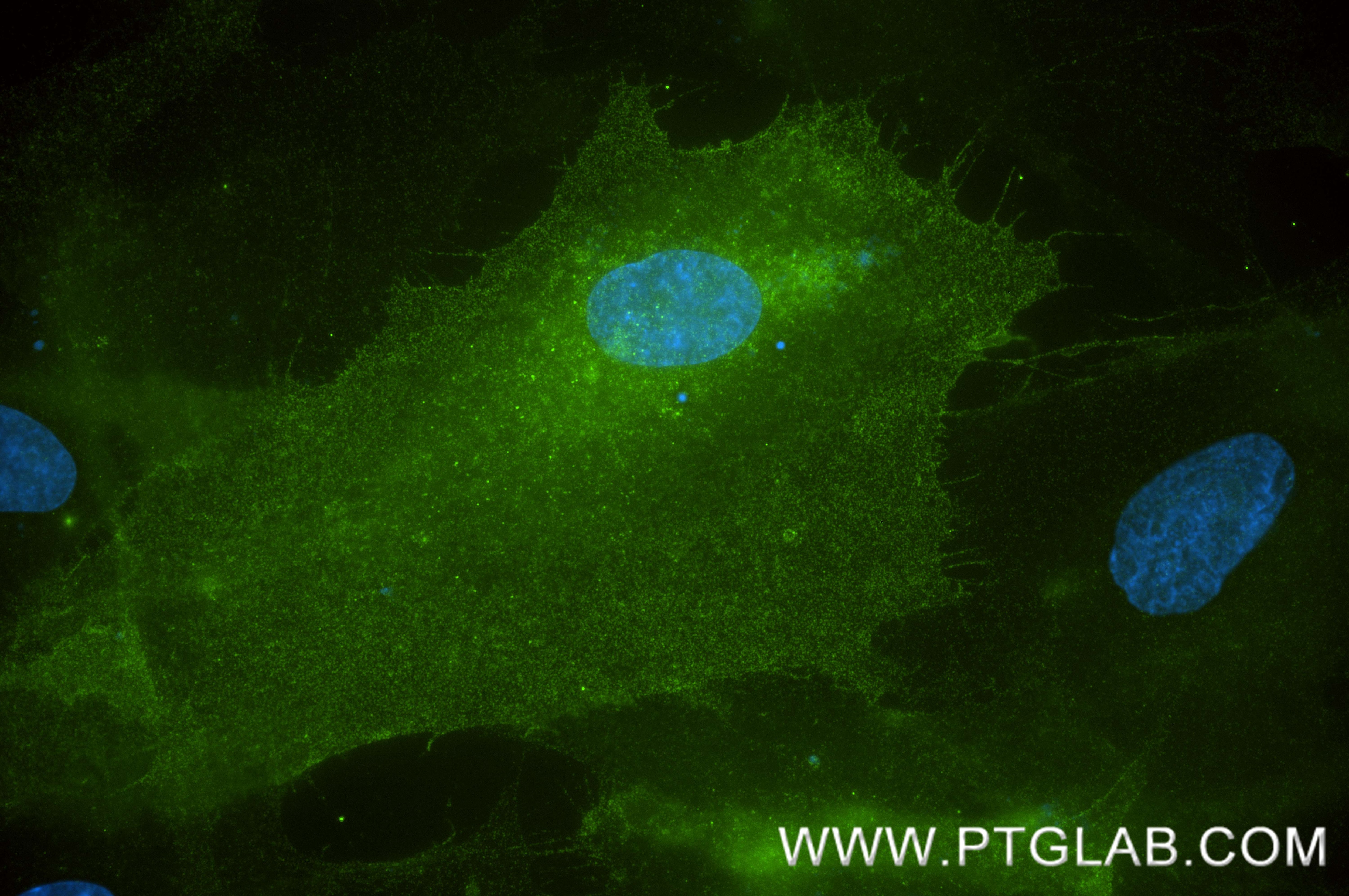 IF Staining of HFF using 84018-4-RR Immunofluorescence (IF) / fluorescent staining of HFF cells using FAP Recombinant monoclonal antibody (84018-4-RR)