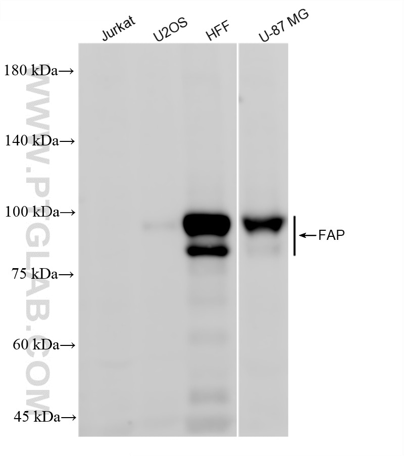 WB analysis using 84018-4-RR Western Blot (WB) analysis of various lysates using FAP Recombinant monoclonal antibody (84018-4-RR)