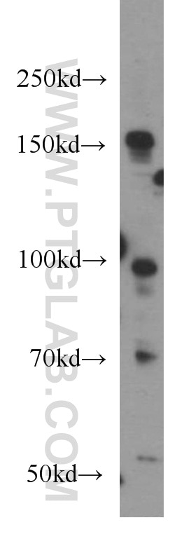 FAPA