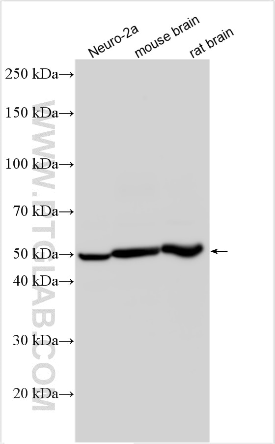 Western Blot (WB) analysis of various lysates using FAR2 Polyclonal antibody (27717-1-AP)