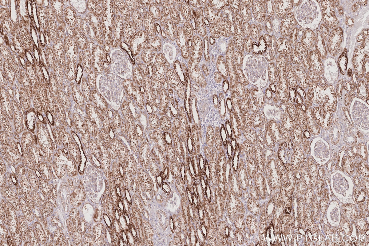 IHC staining of human kidney using 85638-4-RR Immunohistochemistry (IHC) staining of human kidney tissue using FARP1 Recombinant monoclonal antibody (85638-4-RR)