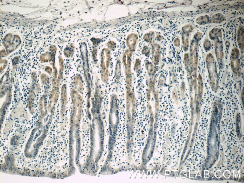 Immunohistochemistry (IHC) staining of human stomach tissue using FARP2 Polyclonal antibody (11488-1-AP)