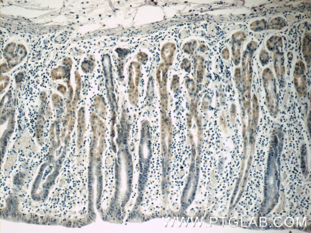 IHC staining of human stomach using 11488-1-AP