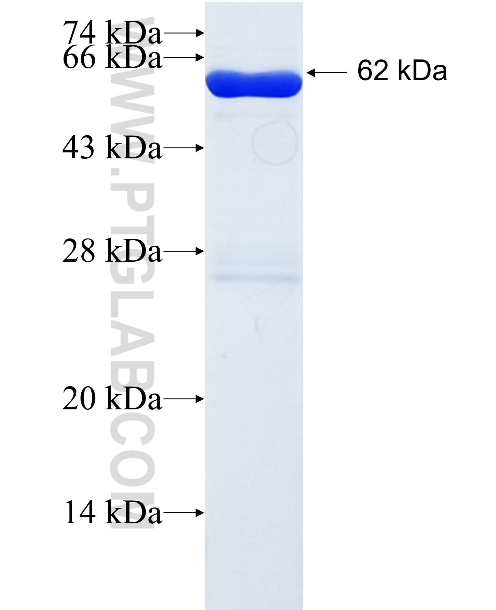 FARP2 fusion protein Ag1990 SDS-PAGE