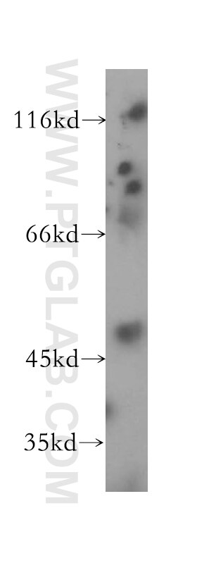 Western Blot (WB) analysis of human cerebellum tissue using FARS2 Polyclonal antibody (16436-1-AP)