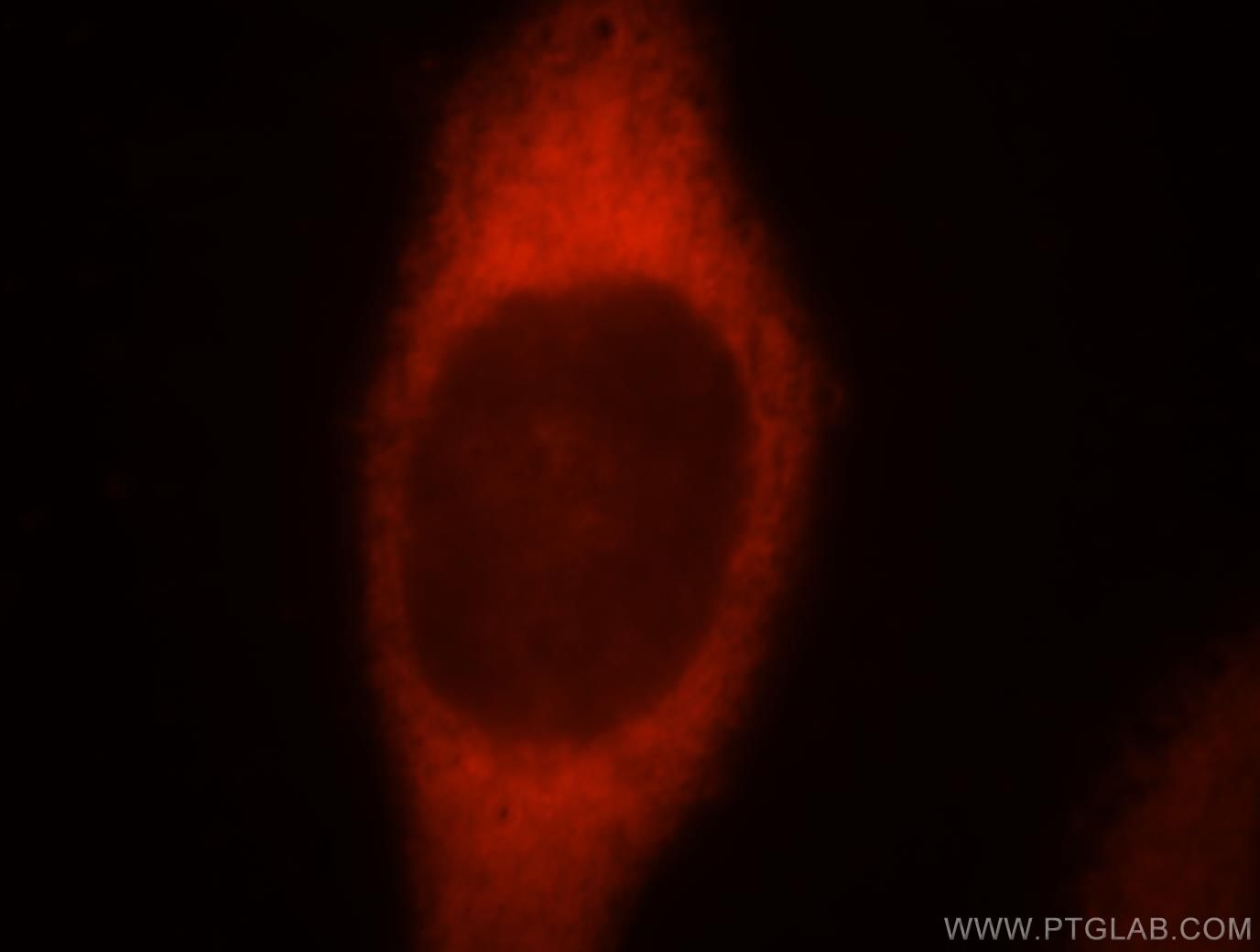 Immunofluorescence (IF) / fluorescent staining of MCF-7 cells using FARSA Polyclonal antibody (18121-1-AP)