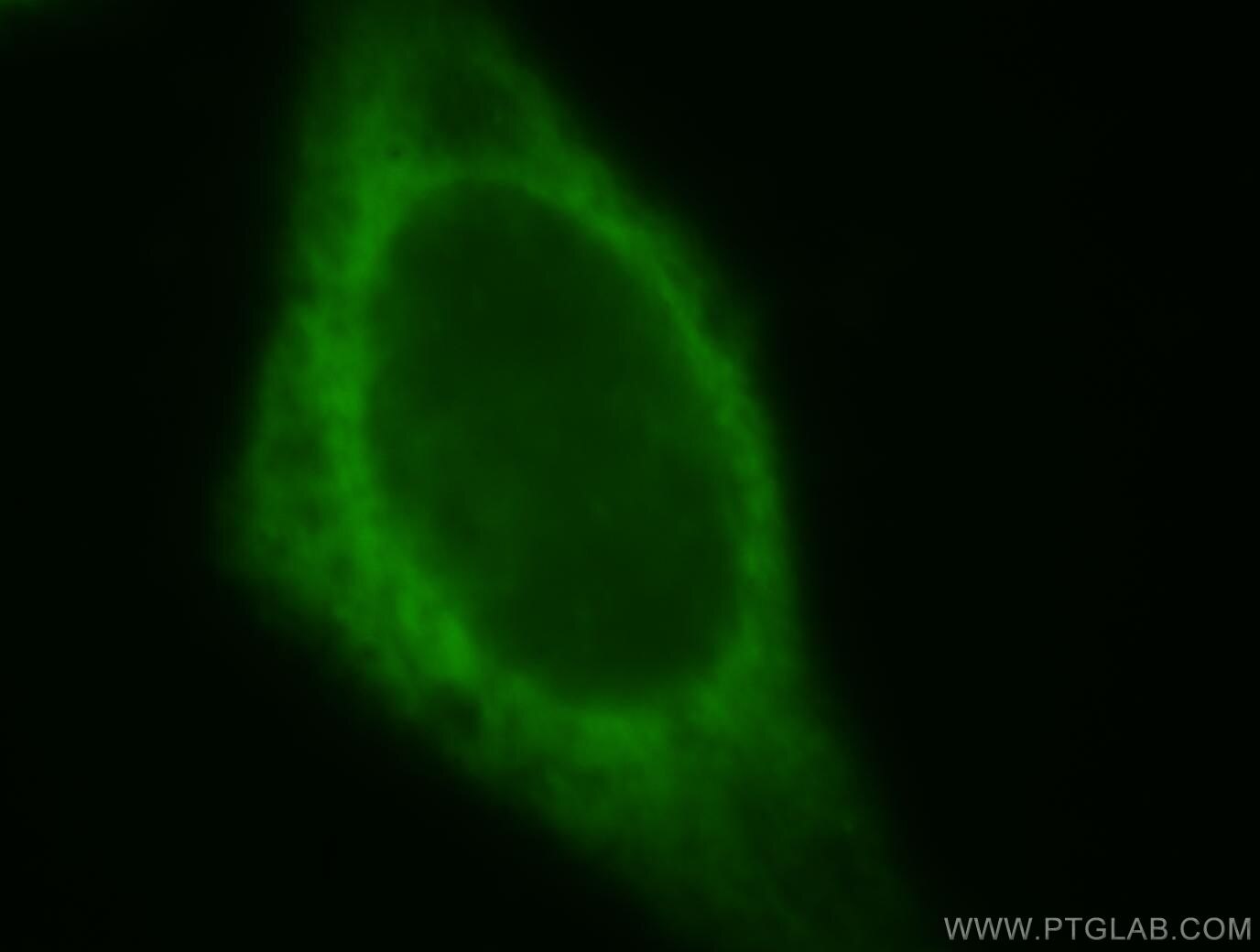 Immunofluorescence (IF) / fluorescent staining of HeLa cells using FARSA Polyclonal antibody (18121-1-AP)