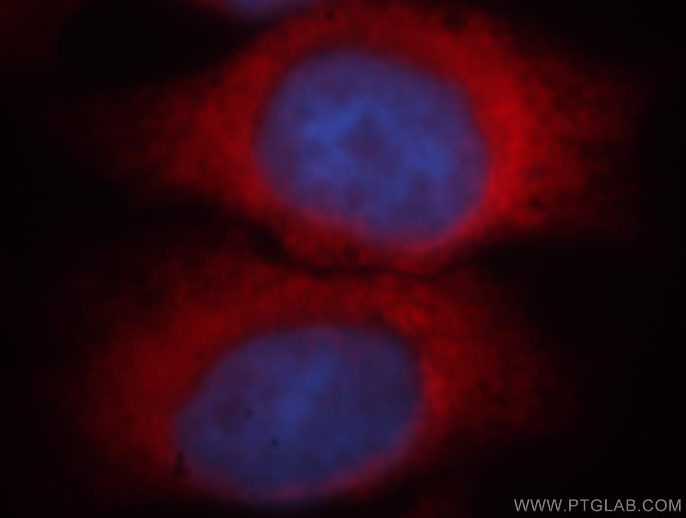 Immunofluorescence (IF) / fluorescent staining of HeLa cells using FARSA Polyclonal antibody (18121-1-AP)