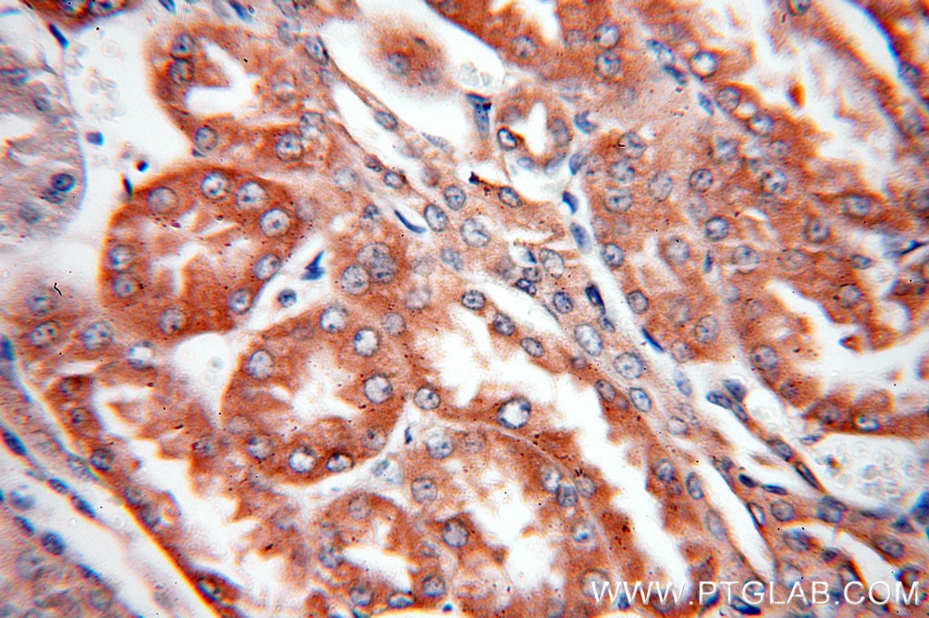 Immunohistochemistry (IHC) staining of human kidney tissue using FARSA Polyclonal antibody (18121-1-AP)