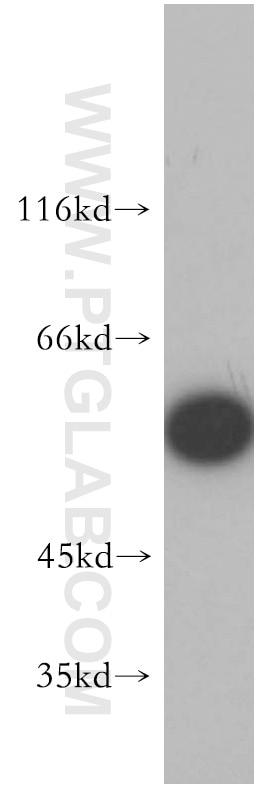 Western Blot (WB) analysis of K-562 cells using FARSA Polyclonal antibody (18121-1-AP)