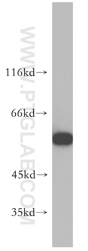 Western Blot (WB) analysis of MCF-7 cells using FARSA Polyclonal antibody (18121-1-AP)
