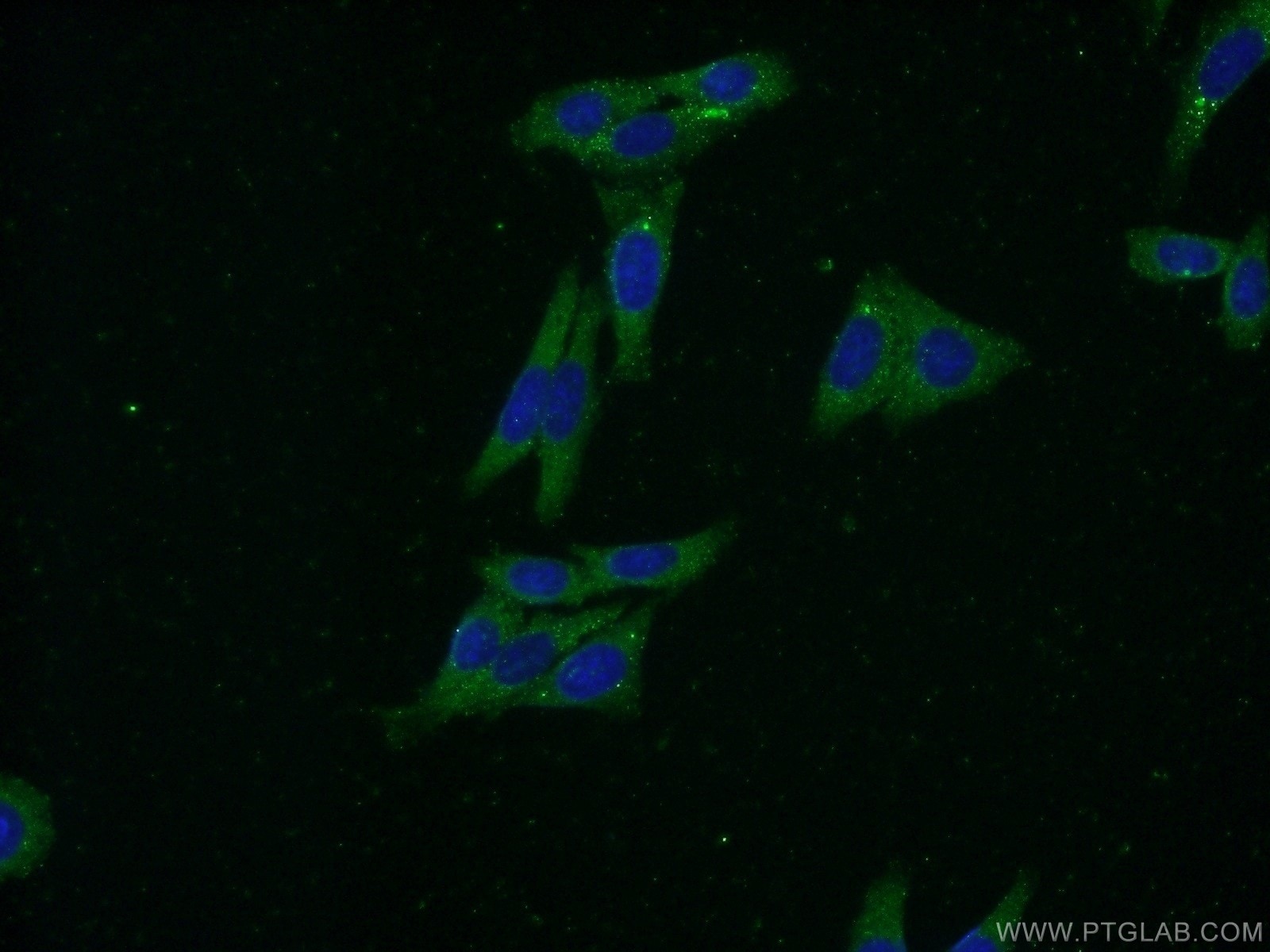 Immunofluorescence (IF) / fluorescent staining of HepG2 cells using FARSB Polyclonal antibody (16341-1-AP)