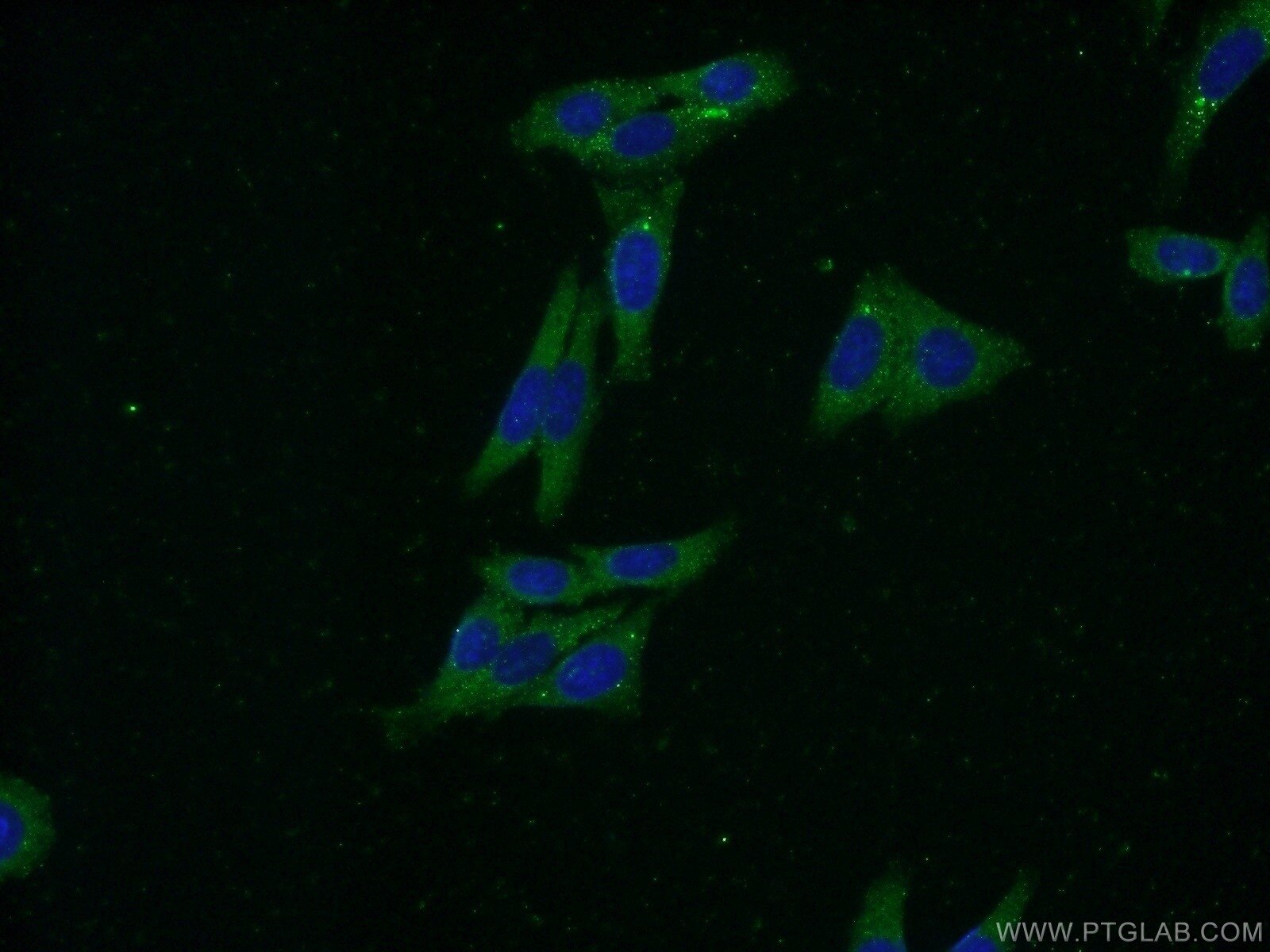 IF Staining of HepG2 using 16341-1-AP