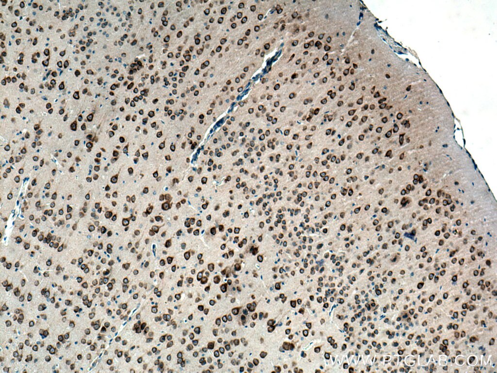 Immunohistochemistry (IHC) staining of mouse brain tissue using FARSB Polyclonal antibody (16341-1-AP)