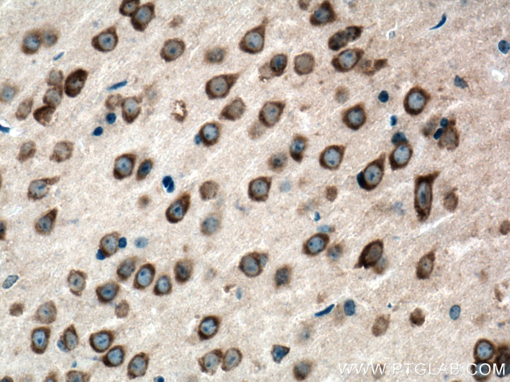 Immunohistochemistry (IHC) staining of mouse brain tissue using FARSB Polyclonal antibody (16341-1-AP)