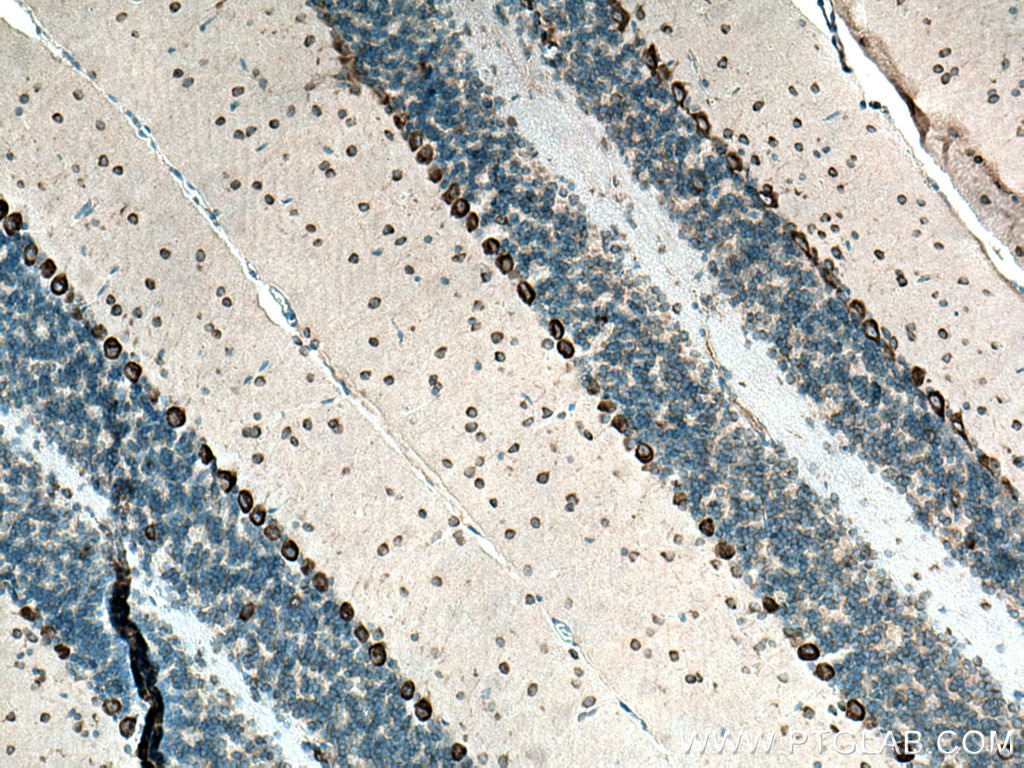 Immunohistochemistry (IHC) staining of mouse cerebellum tissue using FARSB Polyclonal antibody (16341-1-AP)