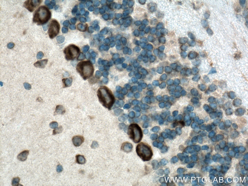 Immunohistochemistry (IHC) staining of mouse cerebellum tissue using FARSB Polyclonal antibody (16341-1-AP)