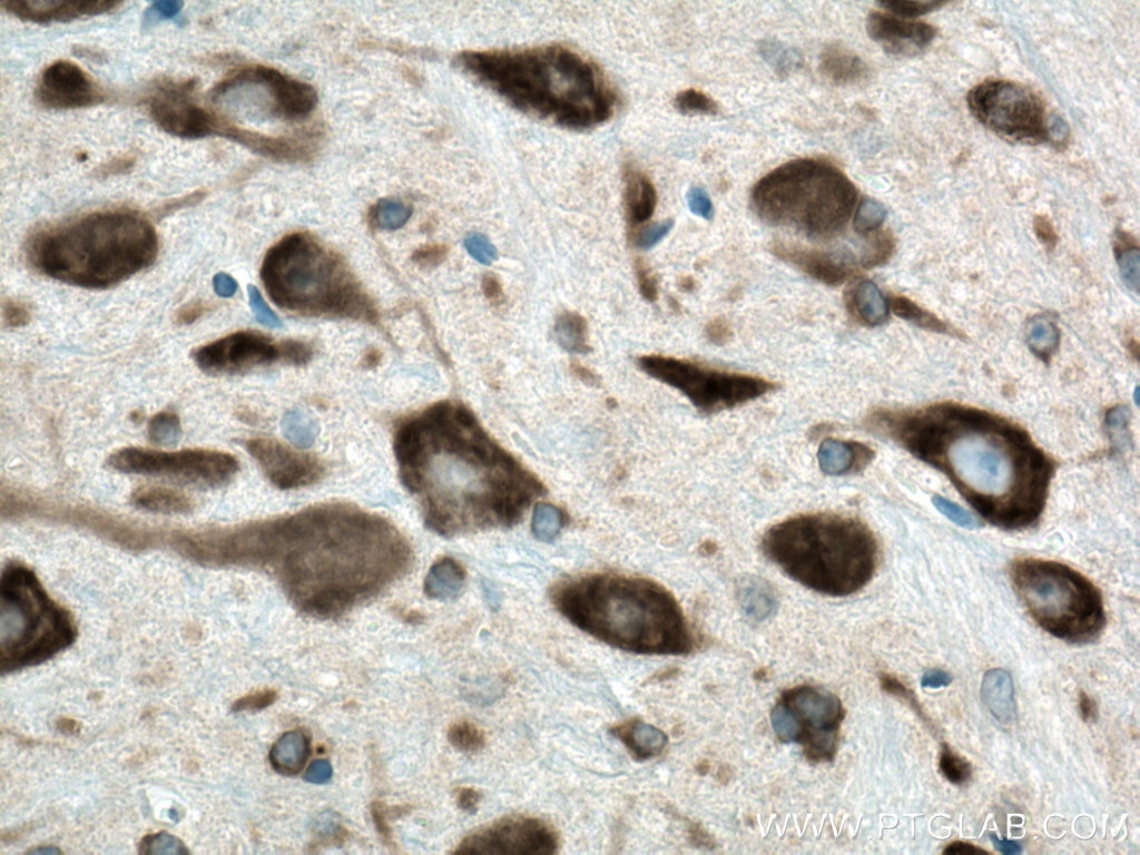 Immunohistochemistry (IHC) staining of mouse cerebellum tissue using FARSB Polyclonal antibody (16341-1-AP)
