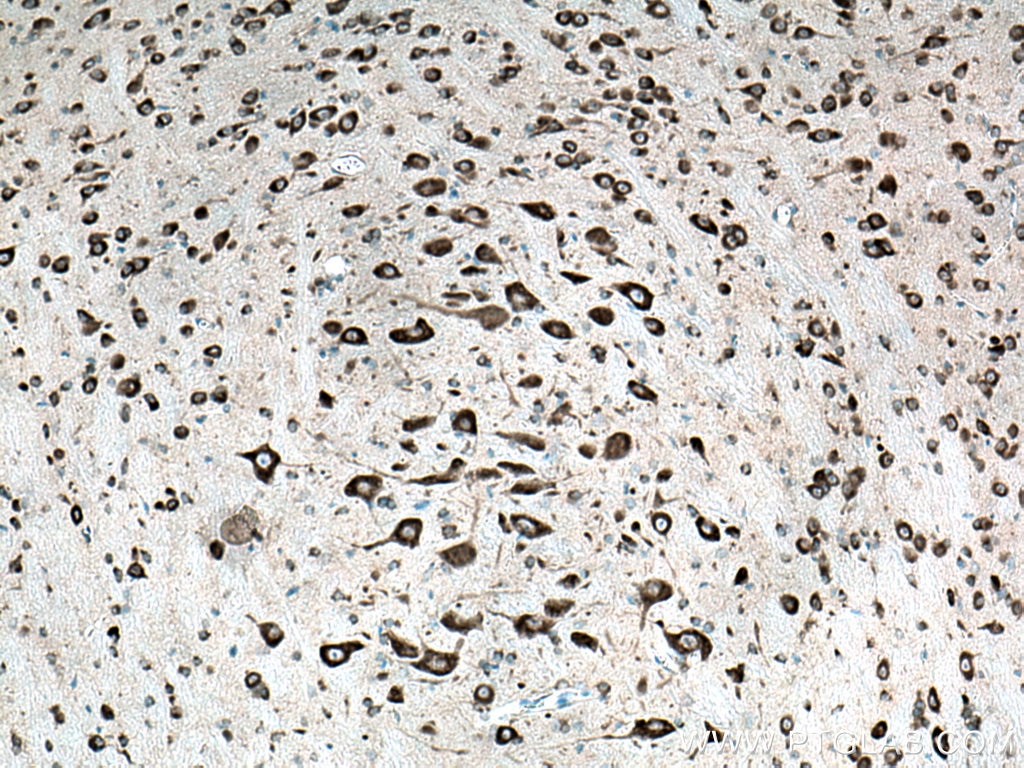 Immunohistochemistry (IHC) staining of mouse cerebellum tissue using FARSB Polyclonal antibody (16341-1-AP)