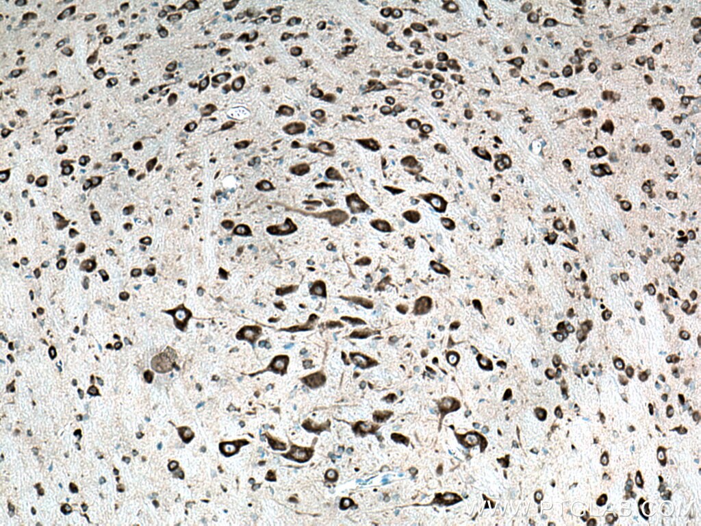 Immunohistochemistry (IHC) staining of mouse cerebellum tissue using FARSB Polyclonal antibody (16341-1-AP)