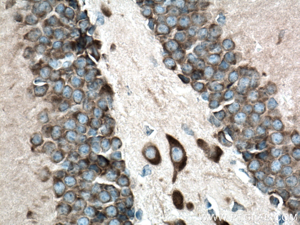 Immunohistochemistry (IHC) staining of mouse brain tissue using FARSB Polyclonal antibody (16341-1-AP)