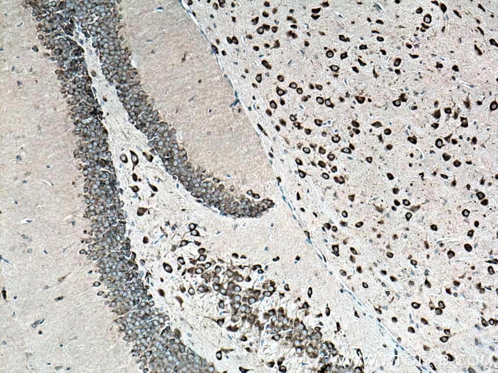 IHC staining of mouse brain using 16341-1-AP