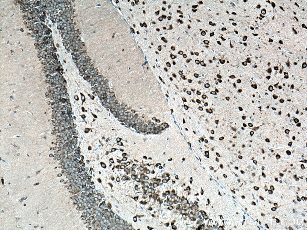 Immunohistochemistry (IHC) staining of mouse brain tissue using FARSB Polyclonal antibody (16341-1-AP)