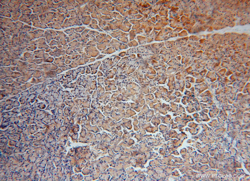 Immunohistochemistry (IHC) staining of human pancreas tissue using FARSB Polyclonal antibody (16341-1-AP)