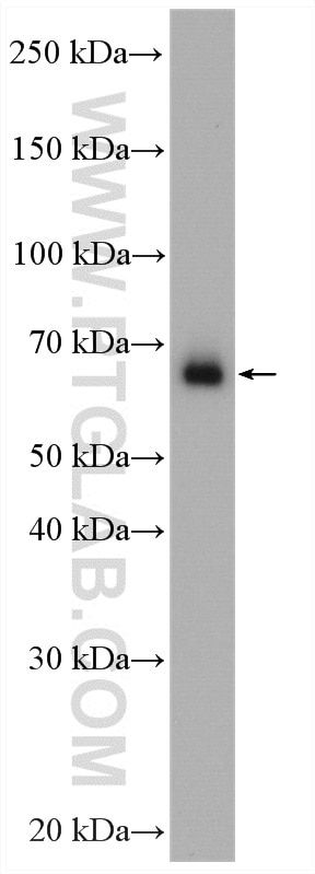 Western Blot (WB) analysis of HeLa cells using FARSB Polyclonal antibody (16341-1-AP)